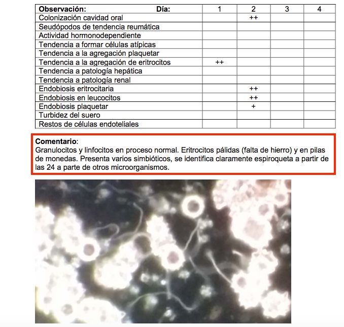 espiroquetes_camp_fosc còpia.jpeg